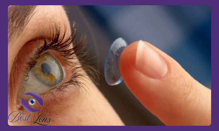 بررسی روش استفاده از لنز‌های طبی رنگی برای افزایش راحتی چشم